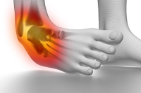 Causes of Ankle Sprains and Prevention Tips